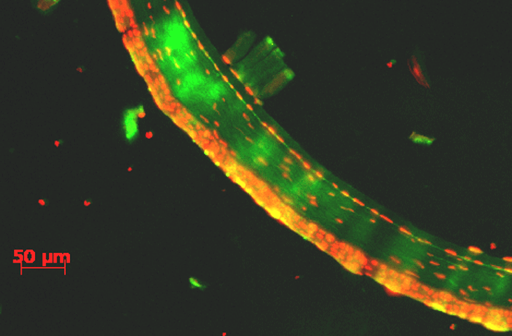 intracellular drug delivery on cornea using novochizol suspensions