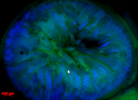 intracellular drug delivery on intestines using chitosan suspensions