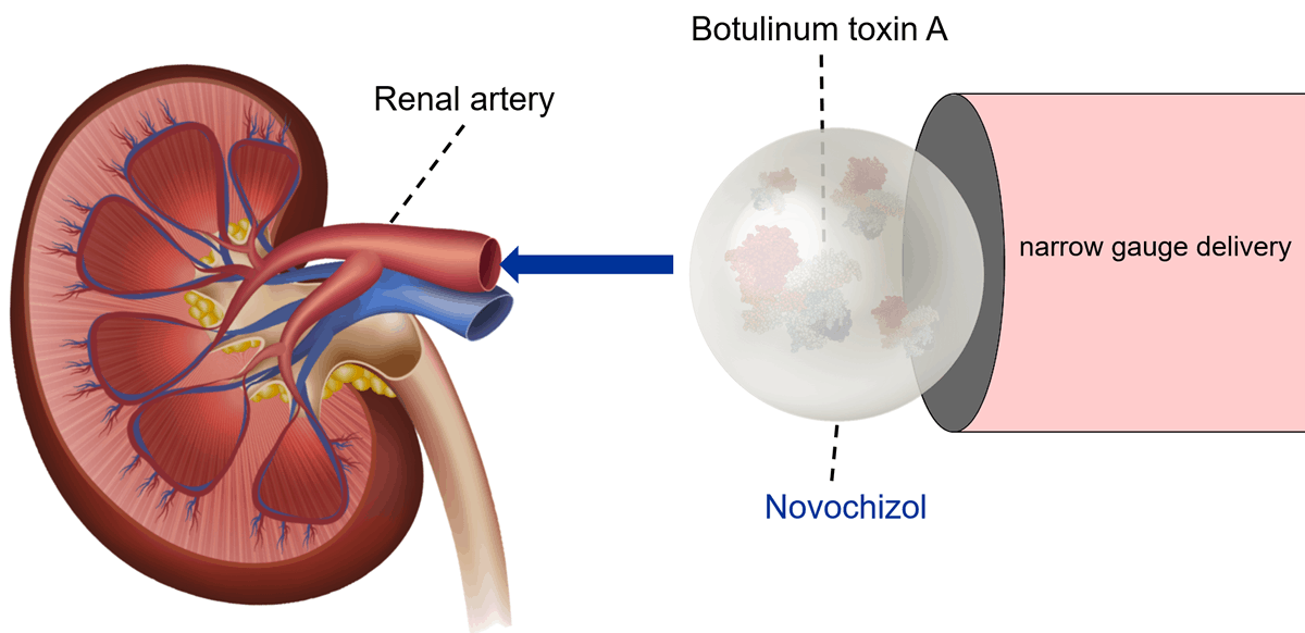 Hypertension: in situ inhibition of renin release