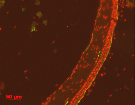 cornea_chitosan intracellular drug delivery on cornea using chitosan suspensions