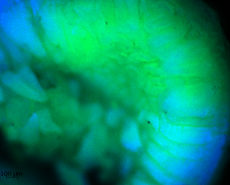 intestines_novochizol intracellular drug delivery on intestines using novochizol suspensions