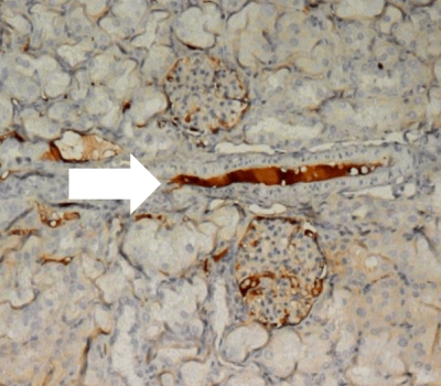 kidneys intracellular drug delivery on kidneys